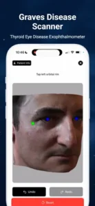 Graves' and Thyroid Eye Disease App