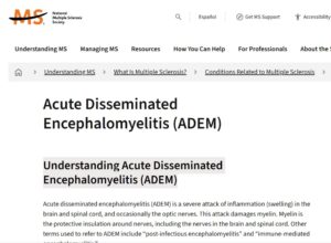 Understanding ADEM